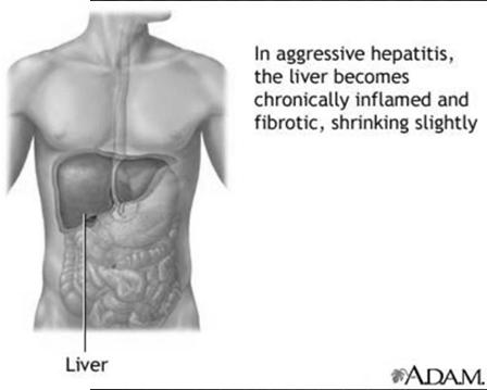 Many people are recommended to receive hepatitis A vaccine, including people at increased risk for