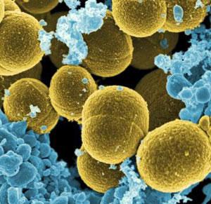 Staphylococcus epidermidis Gram positive bacteria Part of normal human flora