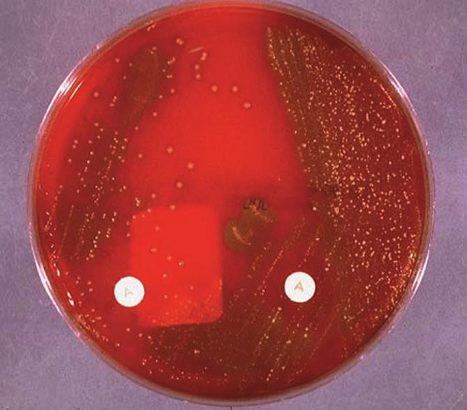 Figure 1. The lysing effect of Streptococcus pyogenes on blood agar. chains or in pairs.