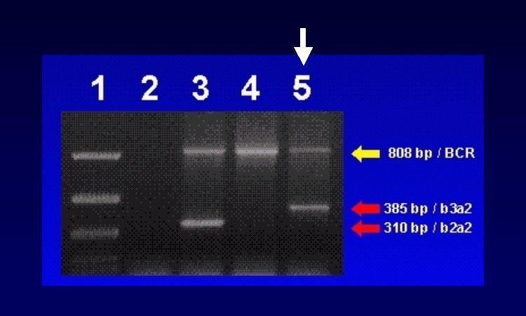 6 RT-PCR