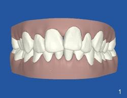View your 3-D smile animation on-line Once you have provided us with your e-mail address, you will receive a welcome message via e-mail.