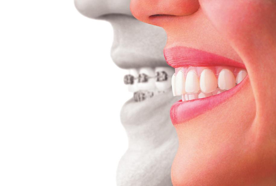 By Dr. Maryann Kriger, D.D.S - Board Certified Orthodontist