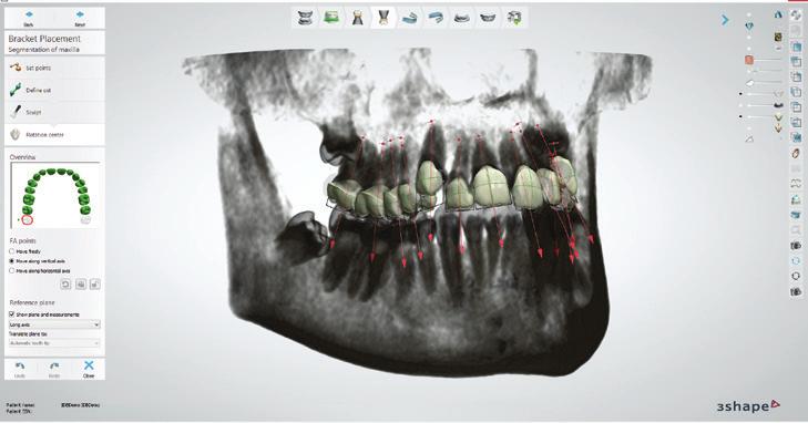 3Shape orthodontic solution complete digital solution for orthodontic clinics and laboratories Include X1 in your case studies for more efficient diagnostics and