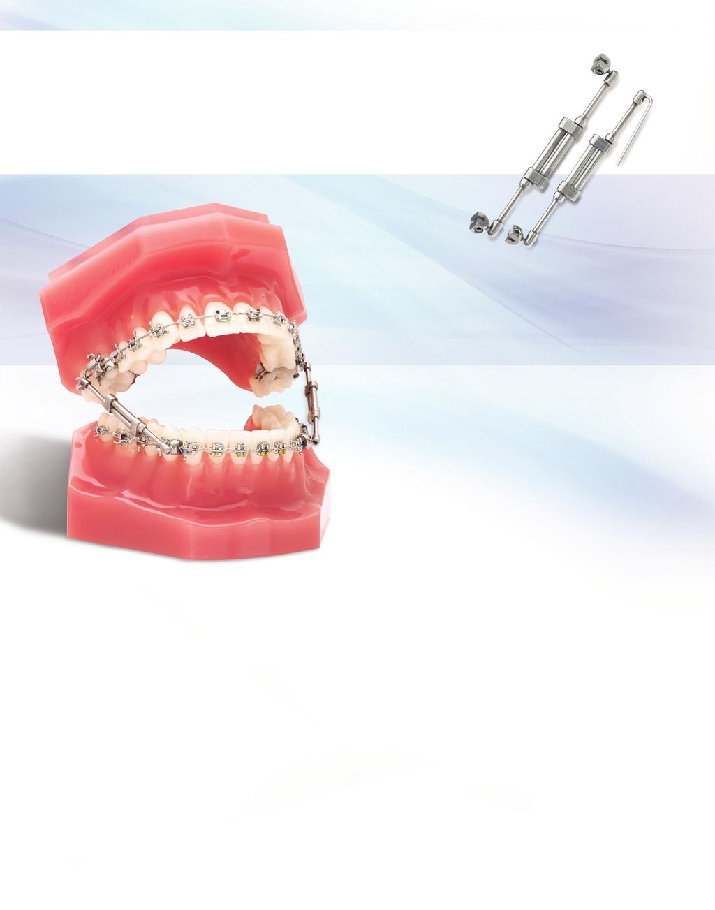 TTCHMENTS TruEase Bite Corrector Devices Innovative Orthodontic Intraoral Devices for the Correction of Class II and Class III