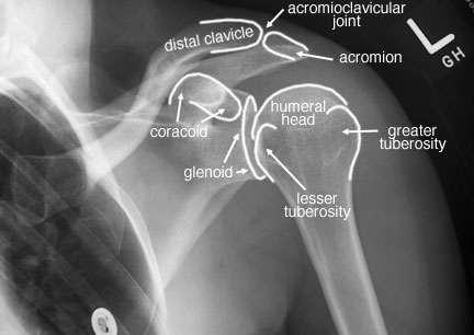 Shoulder Girdle X-Ray