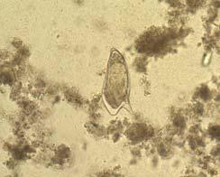 Organism Schistosoma mansoni 99/102 97 10/10 Correct No Parasites Seen 3 3 0 Incorrect Quality Control and Information Participating and referee laboratories agreed that Schistosoma mansoni was the