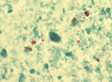 12 N All Parasites Correct identification: Giardia lamblia.