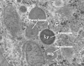 Peroxisomes Vesicles that contain crystalline core of oxidative enzymes. 0.