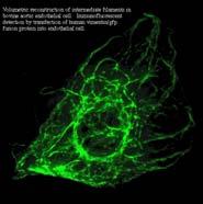 Cytoskeleton Components Intermediate filaments form nuclear lamina, gives cell mechanical strength. Microtubules long, rigid, made of tubulin. Microfilaments long, flexible, made of actin.