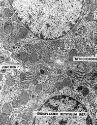 Eukaryotic Cell Organelles Prokaryote vs Eukaryote Structure Cytoplasmic membrane Nucleus