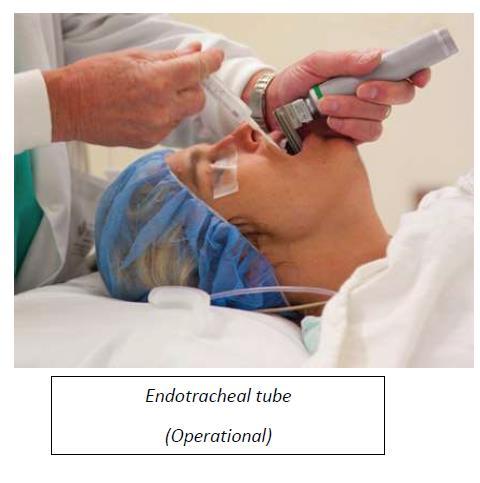 *This (permenant tube) is done if the vocal cords aren t damaged Endotracheal tube (operational) This tube is used only in operations such as during anesthesia to avoid complications and allow air to