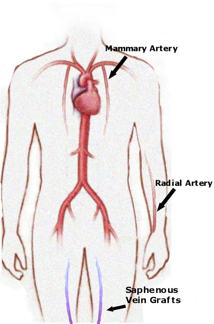 55 The mammary arteries are also called the internal thoracic arteries.