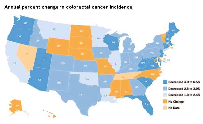 Colon Cancer Screening and