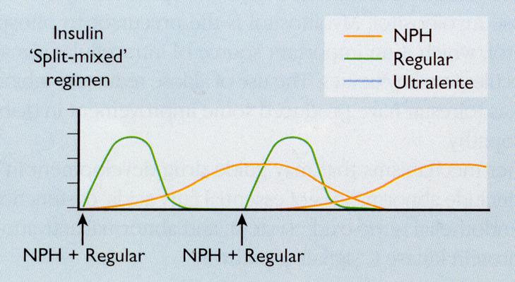 E. Time Profile Curves of Current Insulin Products Lispro (Humalog), Aspart (Novolog), Glulisine (Apidra), Regular (Humulin R), NPH
