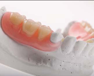 Solution of the said material prevents degradation of a polymer, cleans it in active manner, removes foul smell, dental calculus and pigmentation from removable dentures, trays, mouthguards