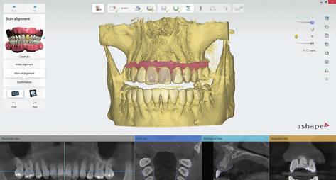 Simplify your clinical workflows with digital models Make your first step into digital orthodontics simple with the TRIOS intraoral scanner and digital models When you are