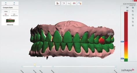 Create your digital patient Save space, time and money by merging TRIOS intraoral and CBCT scans in 3Shape s orthodontics software solution and generate digital study models.