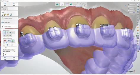 Mill, print or send designs to labs and orthodontic solution providers.
