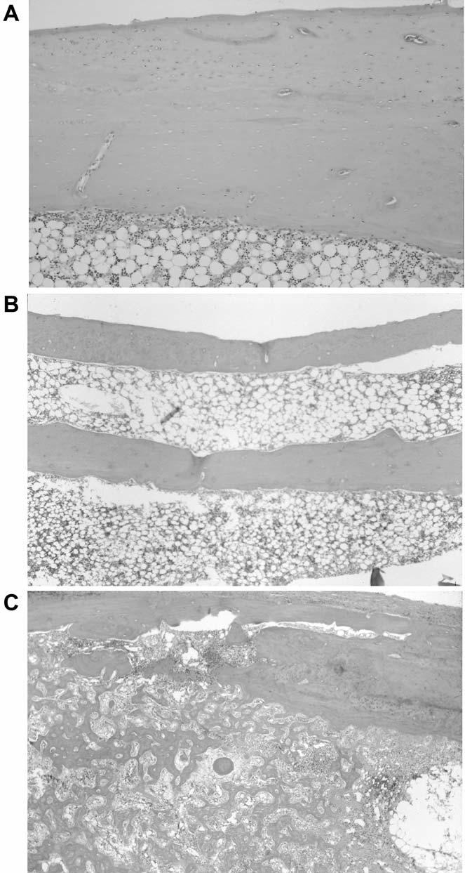 Muramatsu et al:vascularized Bone Graft (Review) Figure 2.
