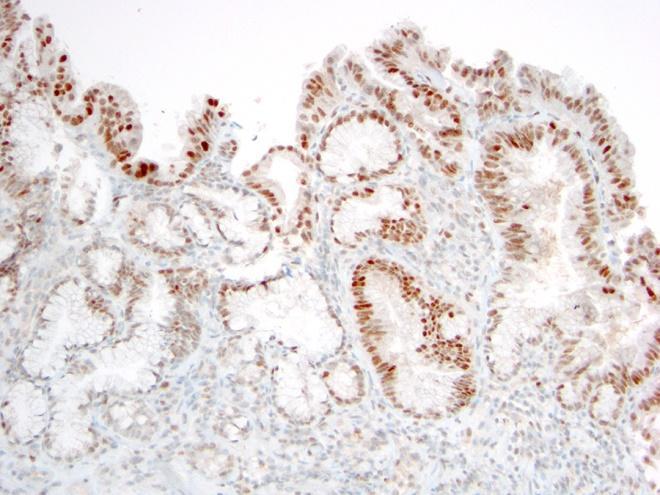 staining nuclei with the p53 stain.