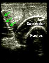 of image can be difficult due to a 90 ⁰ rotation of the anatomy on the ultrasound