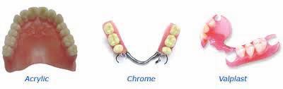 can be used for replacing 1, few or all of your teeth quick sometimes can be done in a few weeks (temporary dentures only) patients who have acrylic dentures often complain that