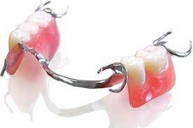 Chrome Partial Dentures Chrome dentures are more of a long term material for a partial denture, as the frame and required components are all cast in one piece.
