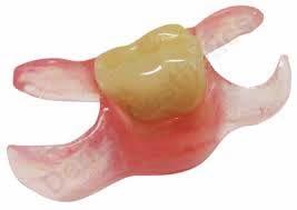 Valoplast dentures (also known as flexi-dentures ) Valoplast dentures are flexible