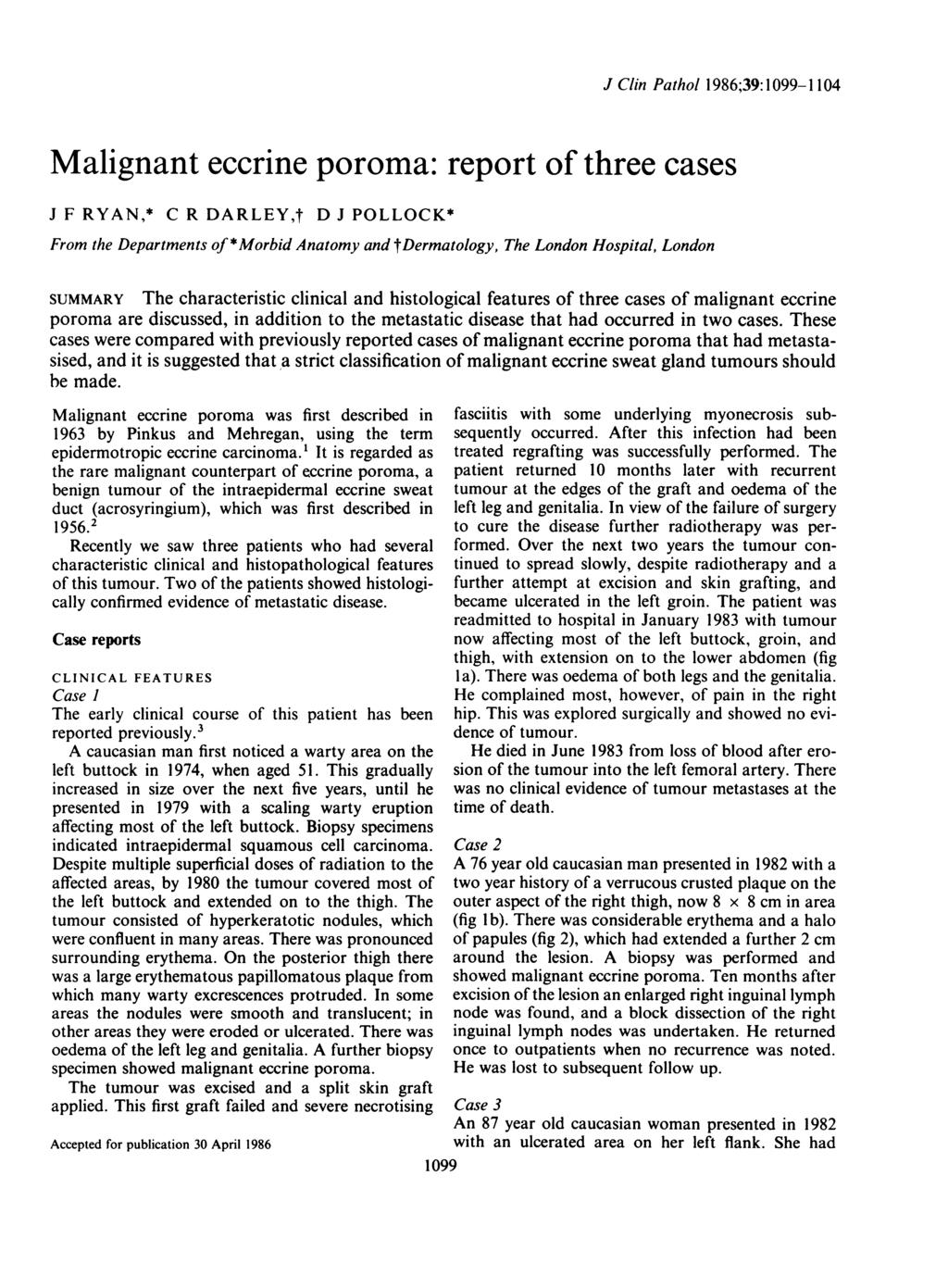 J Clin Pathol 1986;39: 1099-1104 Malignant eccrine poroma: report of three cases J F RYAN,* C R DARLEY,t D J POLLOCK* From the Departments of *Morbid Anatomy and tdermatology, The London Hospital,