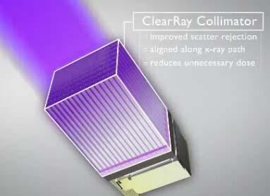 Collimator: Reduces scatter artifact and nonuniformity.
