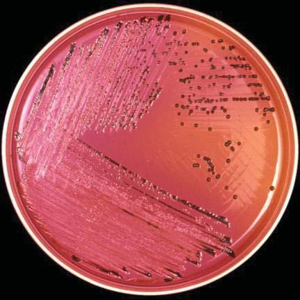 Salmonella Laboratory Diagnosis: The appropriate sample is plated on selentine broth and special media (MacConkey s o,xld media) at 37 C (XLD = Xylose lysine deoxycholate agar ) On XLD: Salmonellae