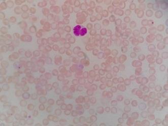 MNPCE PCE NCE Figure 2. The appearance blood smear test animals.