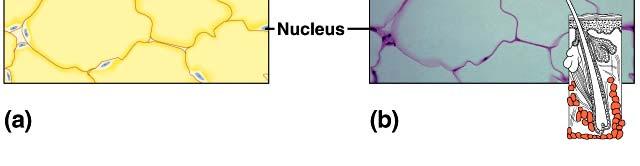 nuclei are pushed