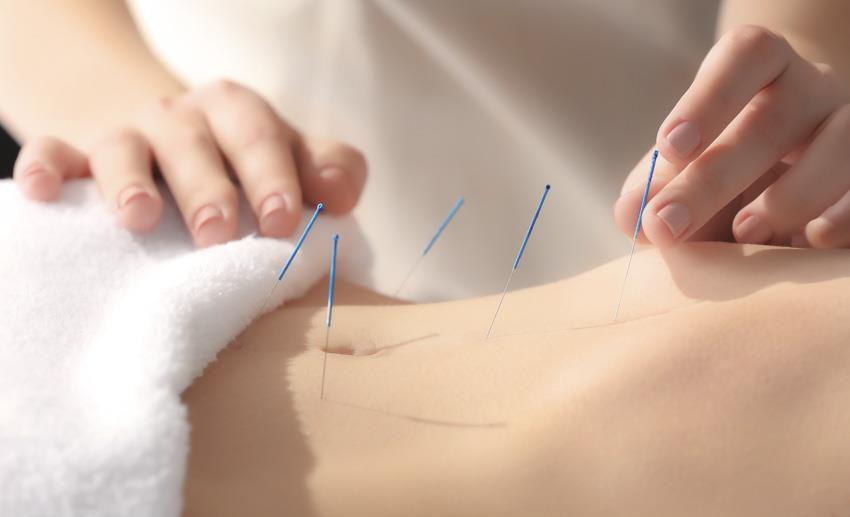 Acupuncture Enhances Fertility Treatment, Lowers Adverse Effects Published by HealthCMI on 08 January 2018. Acupuncture boosts the efficaciousness of fertility treatments.