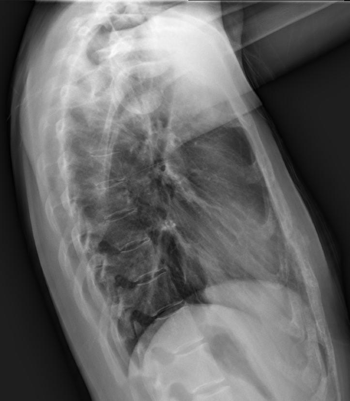 22-year-old woman Because of patient s tilting