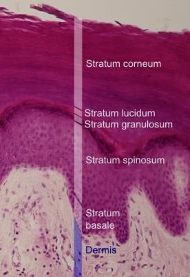 The stratum lucidum is a layer of keratinized cells only found in thick skin.