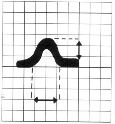 P Waves P waves represent atrial depolarization and spread of electrical impulse through the atria First half of P represents depolarization from the SA node though the RA to