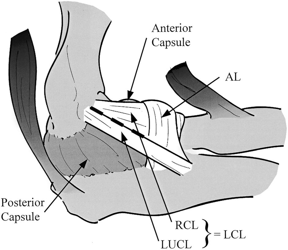 1824 Fig. 1 The lateral collateral ligament complex consists of the radial collateral ligament (RCL), the lateral ulnar collateral ligament (LUCL), and the annular ligament (AL).