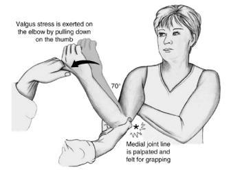 ) Slide 17 Static Valgus Stress Test Evaluate anterior bundle of UCL Supine, forearm pronated, elbow flexed 20-30