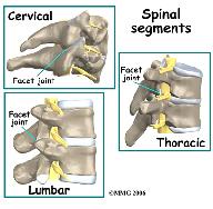 If the facet joint is injected and your pain goes away for several hours, then it is very likely that the joint is causing your pain.