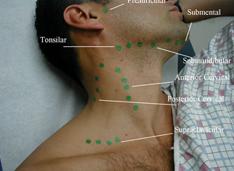 Distribution of LNs Cervical lymph nodes - drain head and neck Axillary lymph nodes - drain arms and breasts Popliteal lymph nodes - drain legs Inguinal lymph nodes -