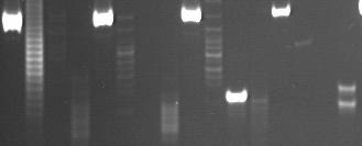 PCR for Antigen Receptor Rearrangement (PARR) Immunoglobulin gene rearrangement V genes n = 100-200 D genes n = 30 J genes n = 6 Germ Line DA excision ucleotide trimming Addition of nucleotides Gene