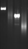 PCR for Antigen Receptor Rearrangement (PARR) Sensitivity= 85% False egatives in 15% of confirmed lymphomas Impossible to design primers capable of detecting all rearrangements Diagnostic gels