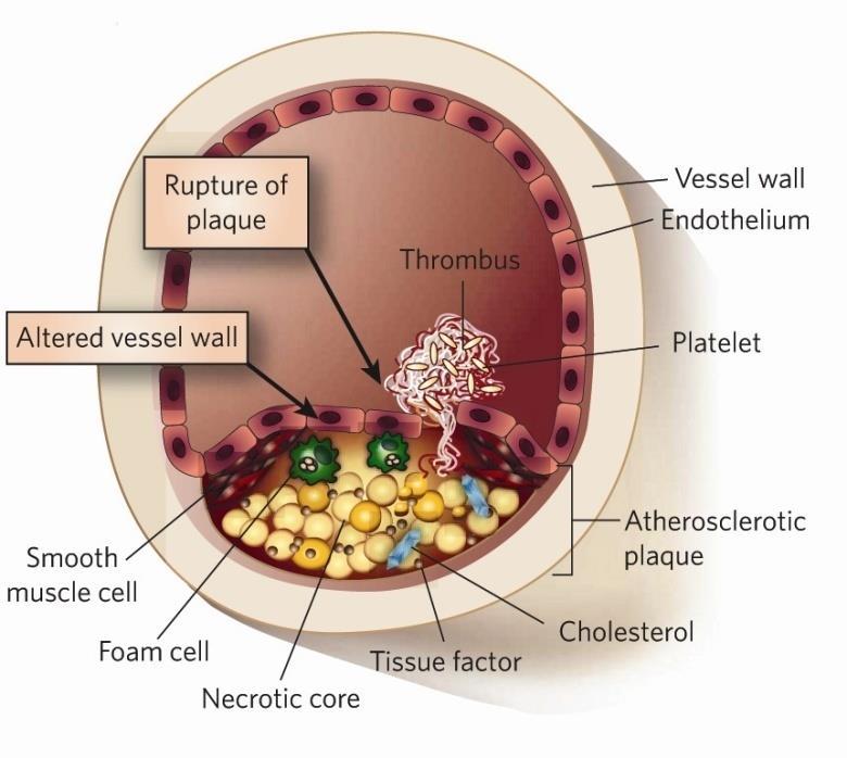 Dual Antiplatelet Therapy: Time for a Paradigm Shift?