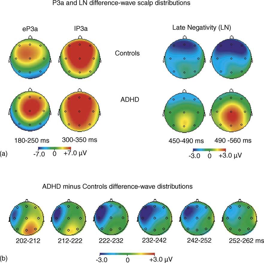216 V. Gumenyuk et al. / Neuroscience Letters 374 (2005) 212 217 Fig. 3. (a) P3a and LN scalp-distribution maps for each group of children.