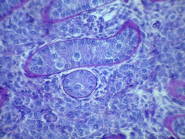 cells Albuginea