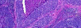lymphocytes Superficial layer this and fragile complete