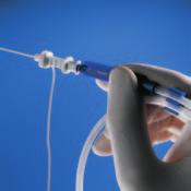 Simple handling When using the Plexolong Catheter Set according to Meier, the catheter is advanced directly through the cannula after nerve stimulation and the injection of the anaesthetic.
