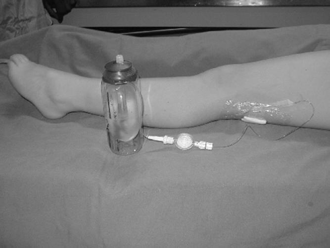 catheter with a disposable