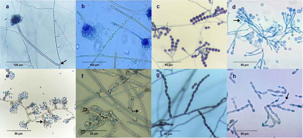 VOL. 48, 2010 AGAR BLOCK SMEAR PREPARATION 3059 The integrity and the native arrangements of conidiophores and sporulating structures are of paramount importance for microscopic species